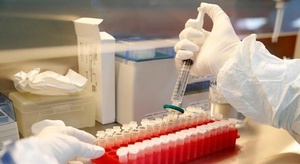 وزير الصحة الإسرائيل