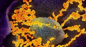 الصحة العالمية  تعلن