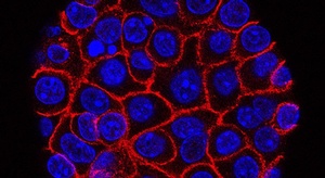 الثوم والبصل يكافحان