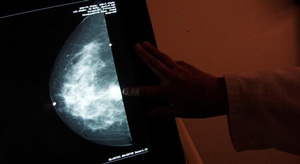 تقنية جديدة لعلاج سر