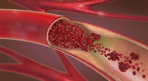 العلماء يحددون أخيرا